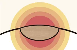 【痛みをやわらげる】